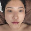 반듯 - 기장군 | 원주윤곽관리 반듯 에스테틱에서 턱선라인 생기고 온 후기