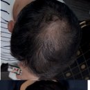 미인모아 아카데미 네이버블로그