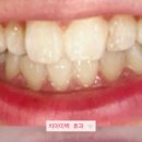 강남애프터치과의원 이미지