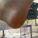 메디메이드산본센타 | 산본 발각질 제거 풋네일 동성제약 풀리메디 군포산본점 솔직후기