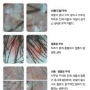 설레임의원 동아일보