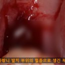 뽑고가요 이미지