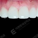 이세상치과기공소 이미지