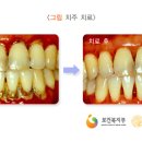 이라고 이미지
