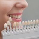 광주치과기공소 네이버블로그