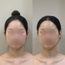 라베니 | 대구 범어동 피부관리 라베니에스테틱 4D입체윤곽 후기!