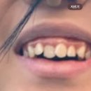 재일 | 닥터재일치과 톤업네이트 후기
