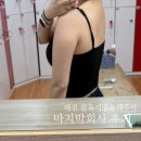 대전 둔산동 다이어트병원에서 팔뚝 지방분해주사 주기 맞춰 맞은 마지막 후기