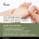나도손톱 레푸스 개봉점 네이버블로그
