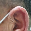 포낙보청기 부산서면센터 이미지