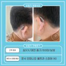 맑은소리보청기 이미지