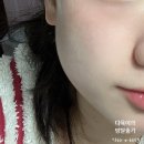 깨순이뷰티 이미지