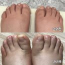 세븐일레븐 평내리치플러스점 | 남양주시 평내호평역 문제성 발관리/티눈/발각질제거 찐 방문 후기 &#34;슈블리왁싱 &amp;푸스인솔