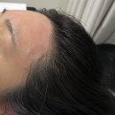 제이샵헤어(J Hair) | [ 경기도 용인 ] 용인왁싱 기흥왁싱전문샵 제이왁싱앤테라피에서 헤어라인왁싱받은 솔직후기