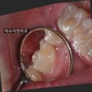 이수자연치과 이미지