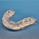 라포치과의원 | 턱관절 치료 후기? 실제 여성 환자분의 고난도 사례 [스플린트, 세정술]