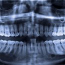 림플란트치과의원 이미지