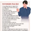 적절한 치료 없으면 &#39;시력 저하&#39; 동반 노인성 안구건조증 ＜5＞ 이미지