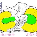 [십자인대파열] 십자인대파열의 치료는 어떻게? 이미지