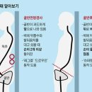 골반 틀어진 듯할 땐, '이 방법'으로 자가진단부터 이미지