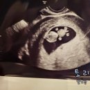 루미산부인과의원 이미지