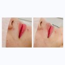 서상동168 | (창원왁싱) 창원인중왁싱을 잘하는 서상동금손언니왁싱입니다🤗