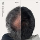 탈모왕 본점 이미지