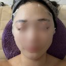 인계동피부관리 수원피부관리 &#39;인뷰티랩&#39; 진피재생관리 대만족 후기!