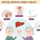 "동반 질환 많은 간암 고령 환자도 치료하면 예후 좋아" 이미지