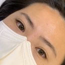 국가대표안경콘택트 | 강남역안과 고도근시 상담 후 스마일라식 라섹 고민중