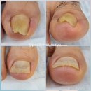 포시뷰티바 이미지