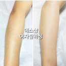 춘천왁싱에스샵왁싱 이미지