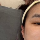 원주혁신도시피부관리 원주송연피부관리샵 페이스케어 관리후기