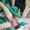 행복한병원 | 대구 현풍 [행복한병원]제왕절개 당일+1일차 후기