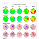 (주)미소메디 | 그냥 게으른 줄 알았던 사람의 과각성형 성인 ADHD 진단 후기 의심증상부터 검사과정까지
