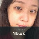 위버스킨 | 수영피부관리 민락역 위버스킨 수분관리 후기
