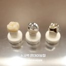 터치과기공소 | 소사역 원데이 지르코니아 :: 원내기공소 &amp; 3d스캐너