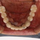 연세좋은치과기공소 이미지