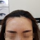 헤어라인 이미지