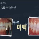 미백천사 - 수원시 영통구 반달로35번길 30 | 미백천사