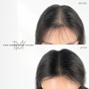 탈모왕수원