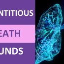 asthma, bronchitis, bronchiectasis, emphysema, lung fibrosis, COPD 청진 탐구!! 이미지