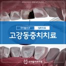 미미고강동 이미지
