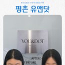 2021-1017 | 정수리 탈모 커버 완료! 안양탈모 1티어 유앤닷