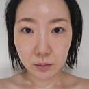 11650-1-10-600 | [청담피부과] 세르프600샷, 4주차 내돈내산 후기, 효과, 부작용, 붓기, 유지기간, 가격, 할인링크