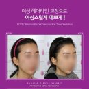 모앤라인성형외과의원 네이버블로그