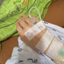 인천하이병원 | 자궁 근종 로봇 수술 후기 Part2. | 인천 부평 성모병원 _ 김용욱 교수님👍🏻 | 수술 당일 | 준비물