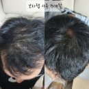 &lt;보타랩후기&gt; 탈모에 좋은샴푸 찾고계신가요?