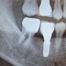 젠치과의원 이미지