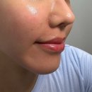 케이더마 이미지